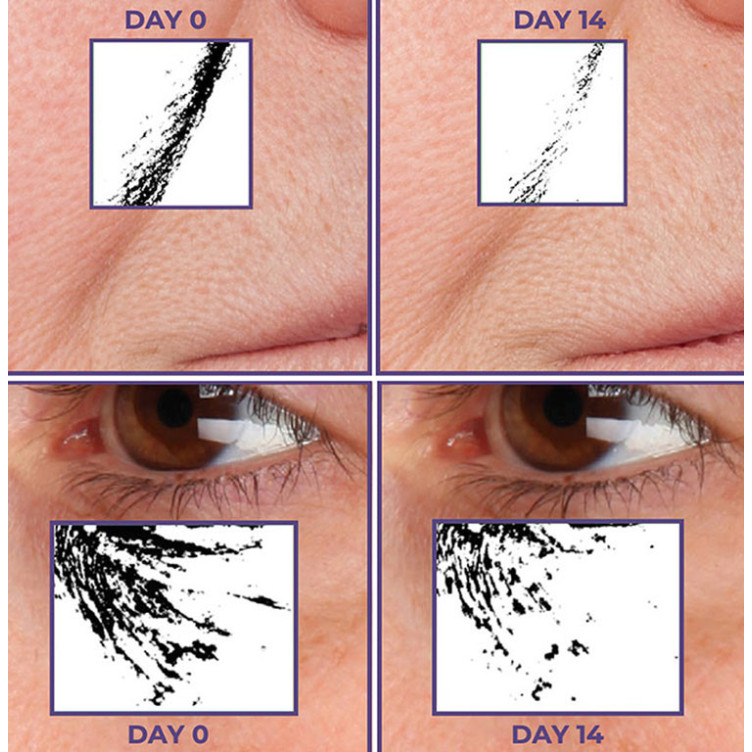 All-In-One Multi-Action...