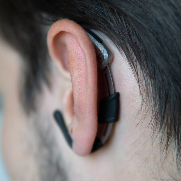 ForgTin Auricular device...